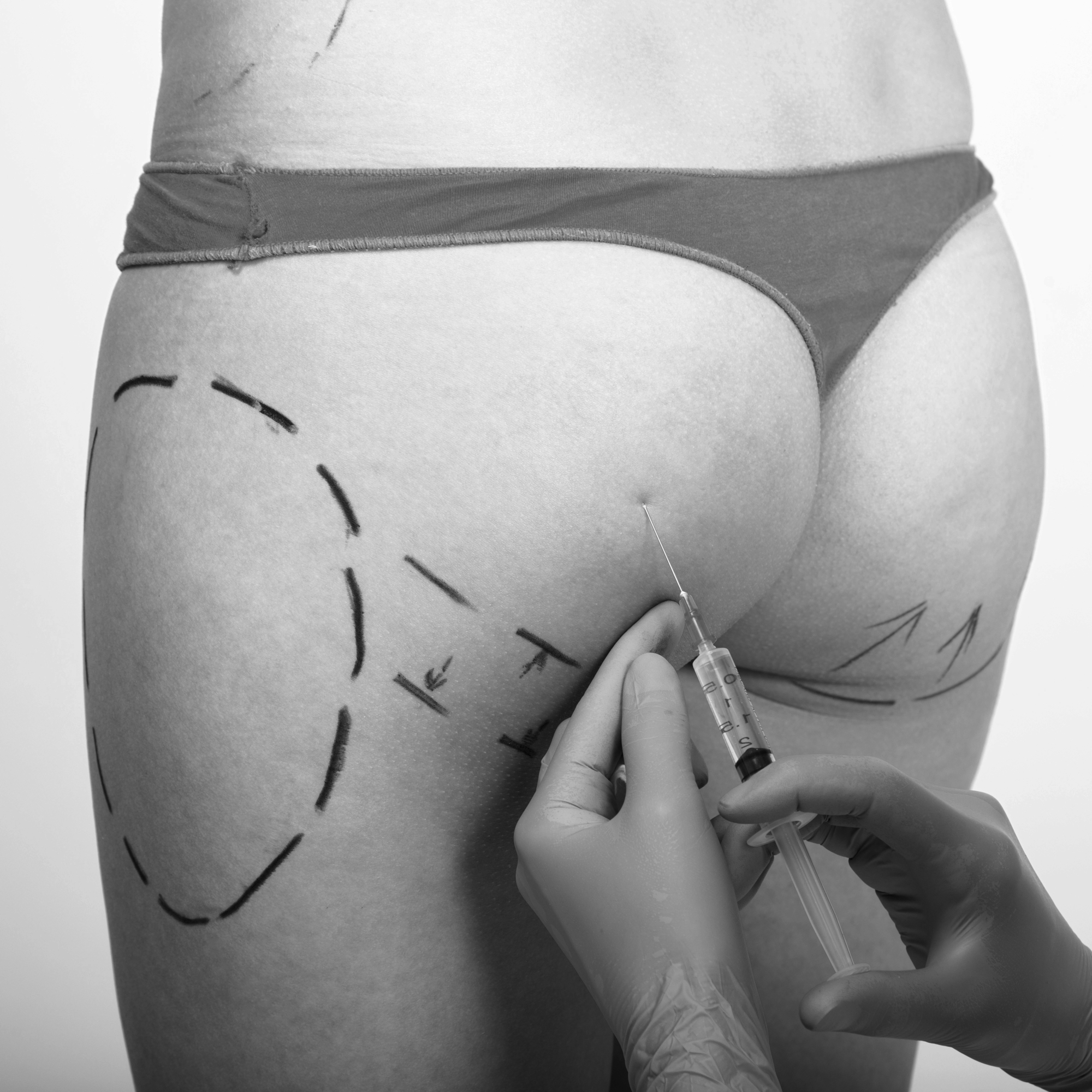 Foto eines Pos, in den mit einer Spritze eine klare Flüssigkeit injiziert wird.